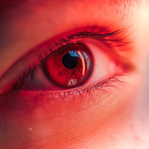 emdr